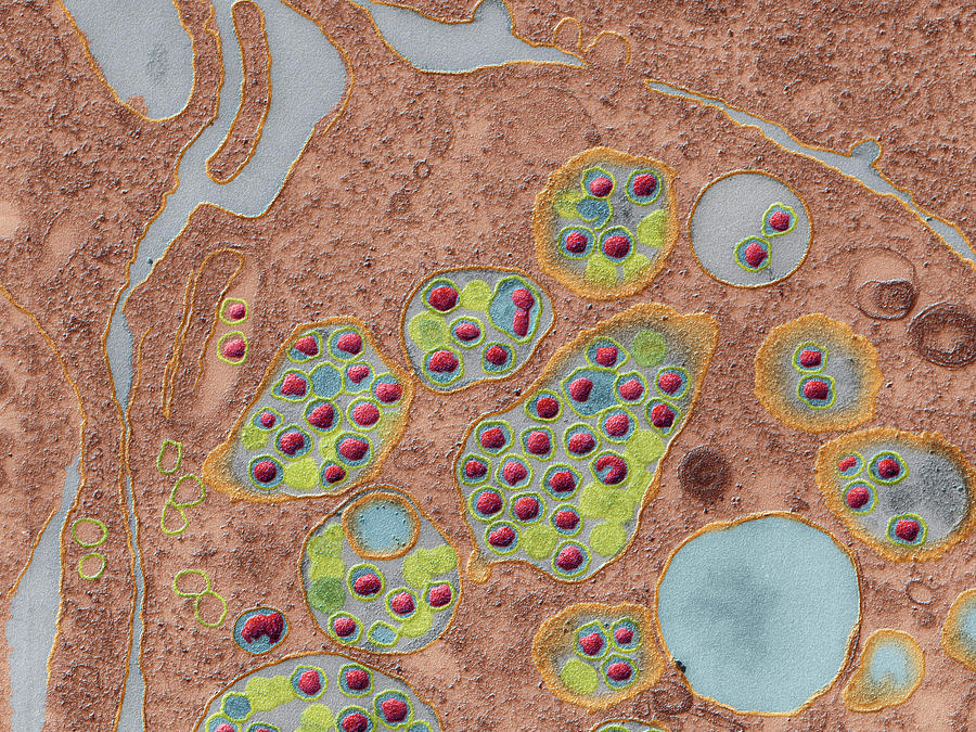 Coronavirus Developing In Cell, Tem #3 Photograph by Oliver Meckes EYE OF SCIENCE