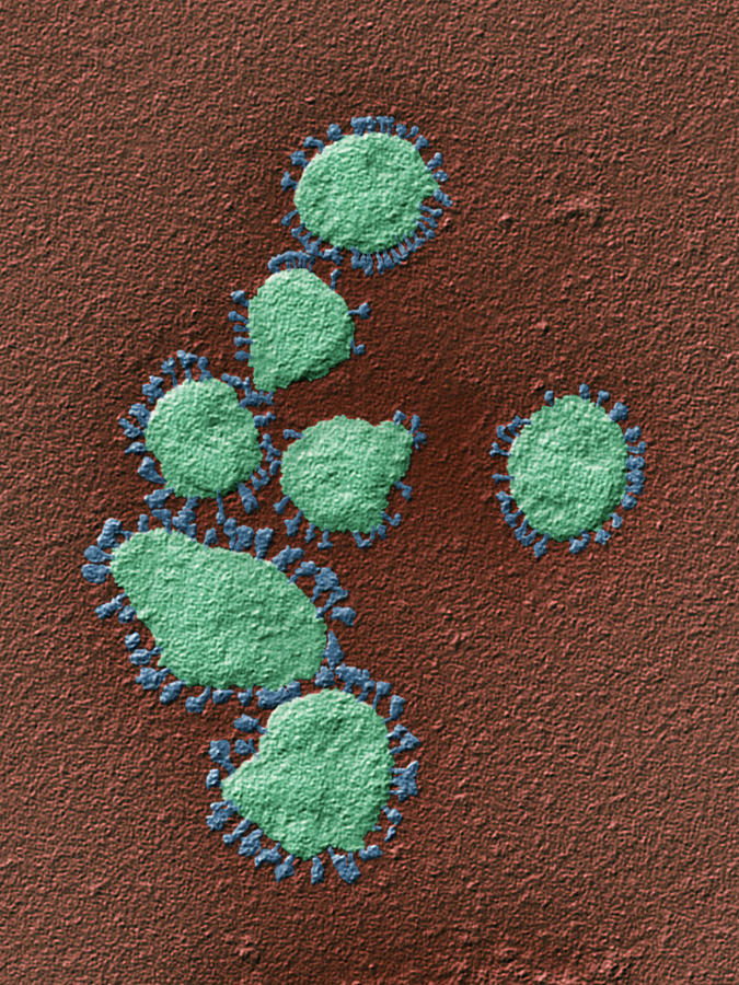 Coronavirus, Tem #3 Photograph by Oliver Meckes EYE OF SCIENCE