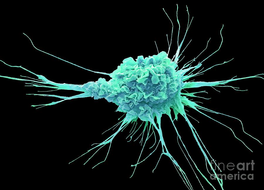 Dendritic Cell #3 Photograph by Steve Gschmeissner/science Photo Library