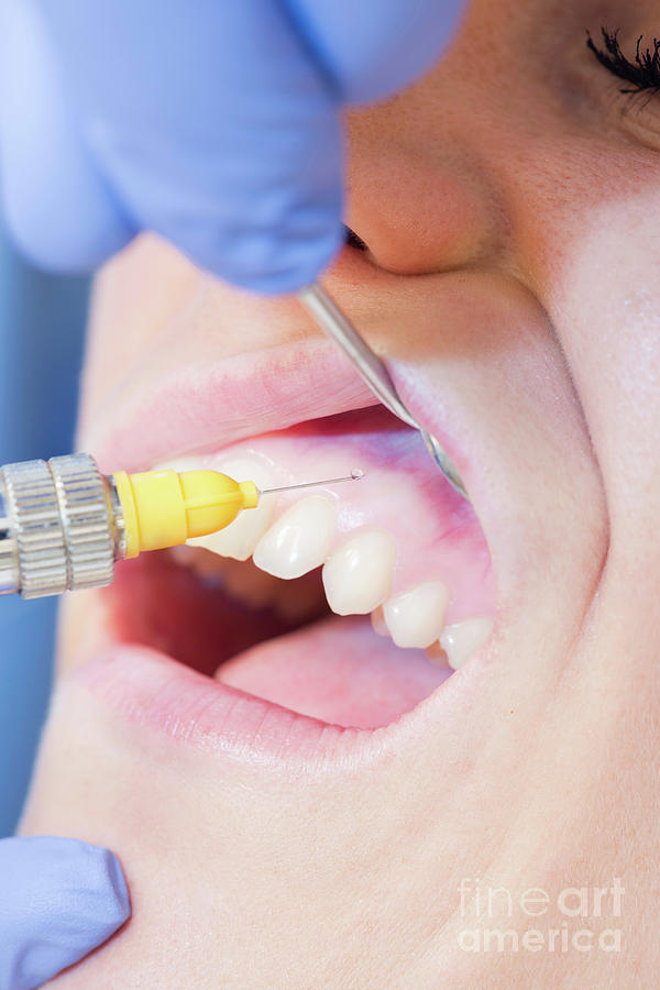 Dental Anaesthesia Photograph By Microgen Images/science Photo Library ...