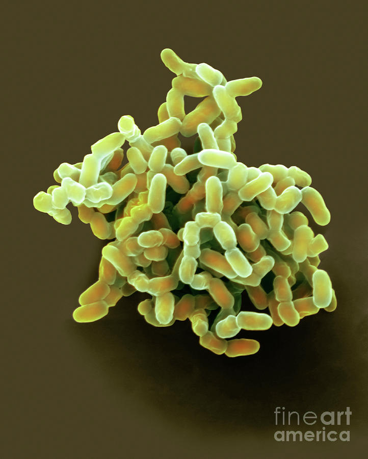 Drug-resistant Tuberculosis Bacteria #3 Photograph by Dennis Kunkel Microscopy/science Photo Library
