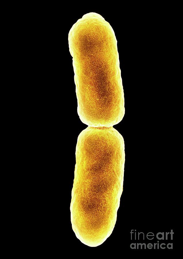 E. Coli Bacterium Dividing #3 Photograph by Dennis Kunkel Microscopy/science Photo Library