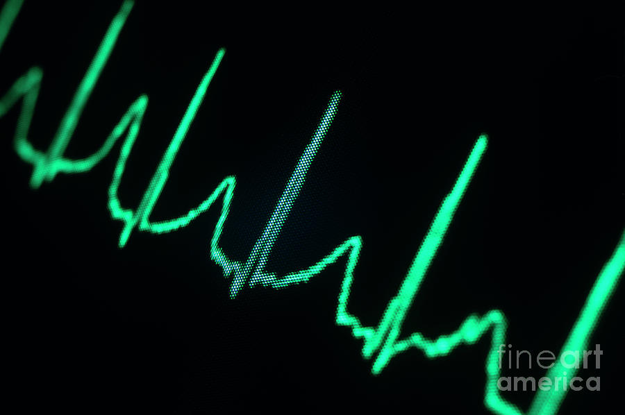 normal heartbeat normal heartbeat