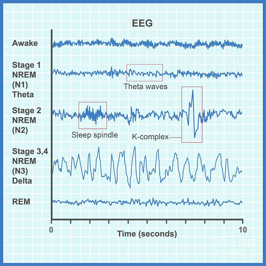 Eeg Sleep Stages #3 Photograph by Cordelia Molloy/science Photo Library