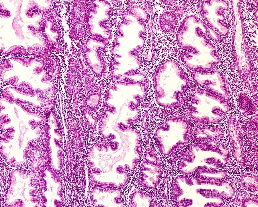 Endometrial Glands In Secretory Phase Photograph By Jose Calvo