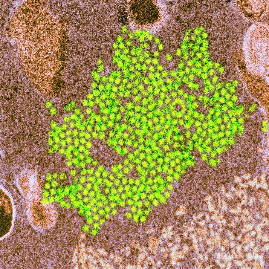 Virus Photograph - Enterovirus 68 Virions #3 by Cdc/science Photo Library
