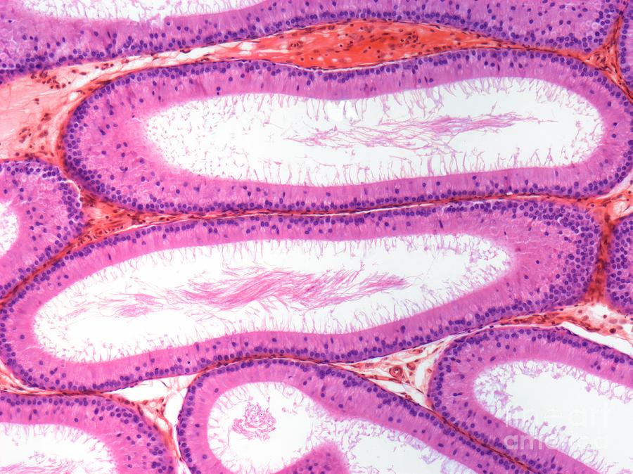 Epididymis Photograph by Steve Gschmeissner/science Photo Library ...