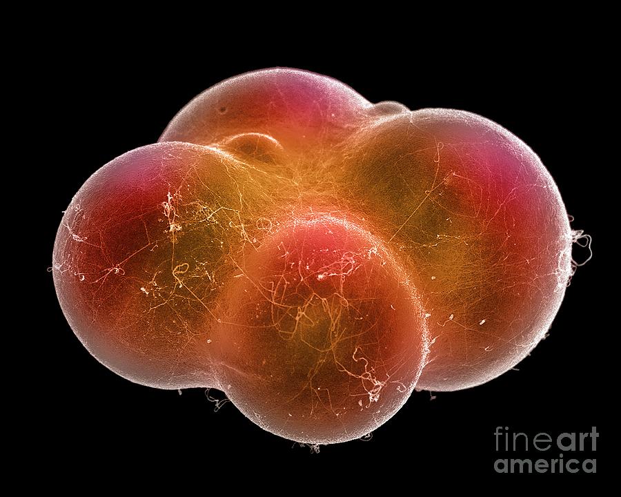 Fat Cells #3 Photograph by Steve Gschmeissner/science Photo Library