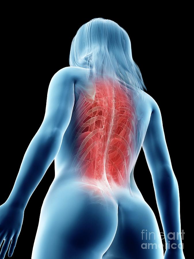 Female Back Muscles #3 by Sebastian Kaulitzki/science Photo Library