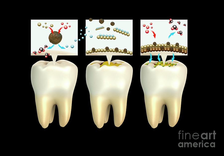 Formation Of Plaque On Teeth #3 Photograph by Mikkel Juul Jensen / Science Photo Library
