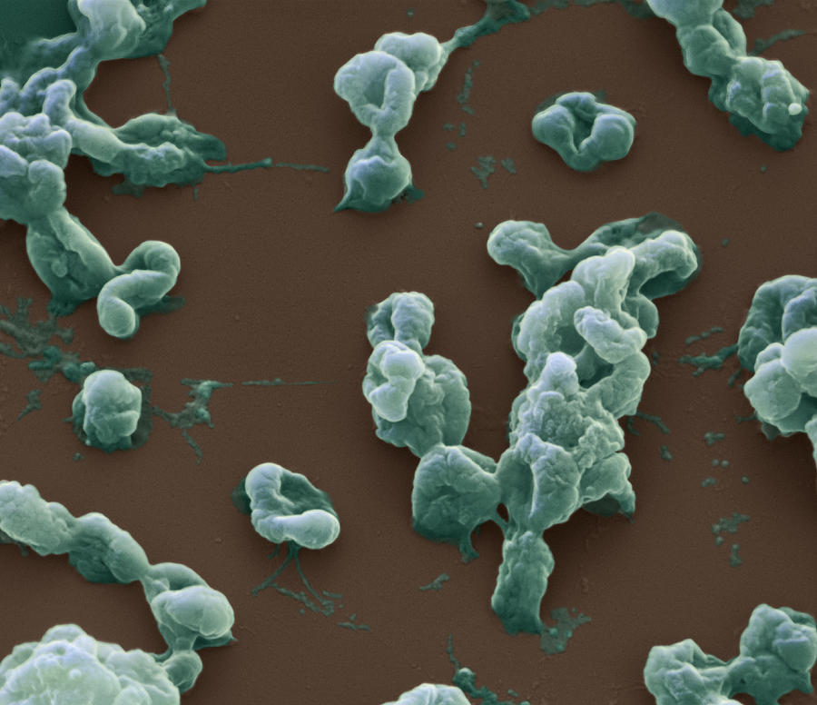 Francisella Tularensis Bacteria Sem #3 Photograph by Meckes/ottawa