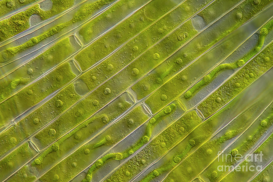 Gonatozygon Kinahanii Algae #3 Photograph by Frank Fox/science Photo Library