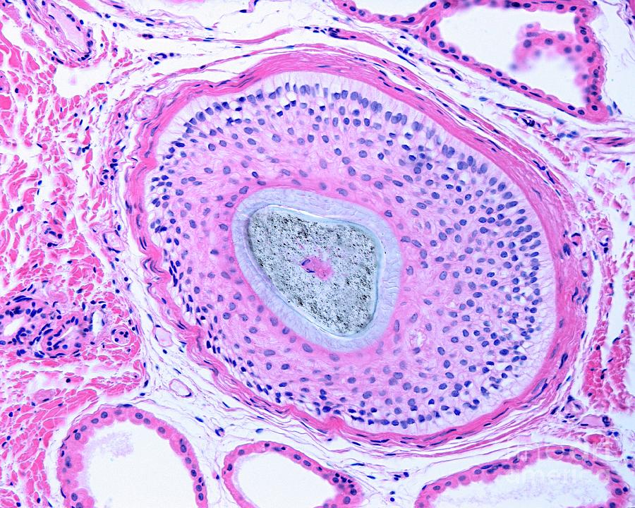 Hair Follicle Photograph by Jose Calvo/science Photo Library