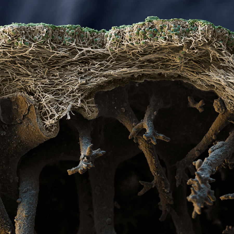 Hammered Shield Lichen #3 Photograph by Meckes/ottawa