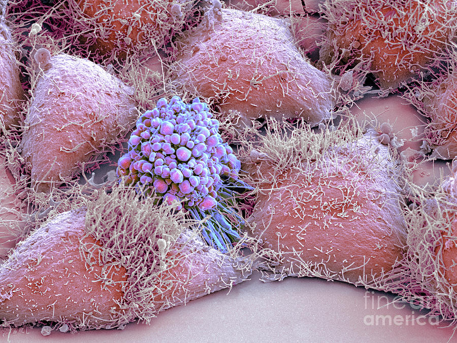 Hela Cells Photograph by Thomas Deerinck, Ncmir/science Photo Library ...