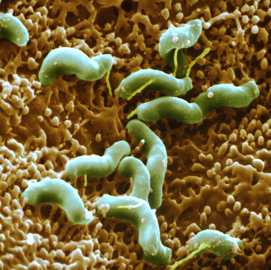 Helicobacter Pylori #3 Photograph by Meckes/ottawa