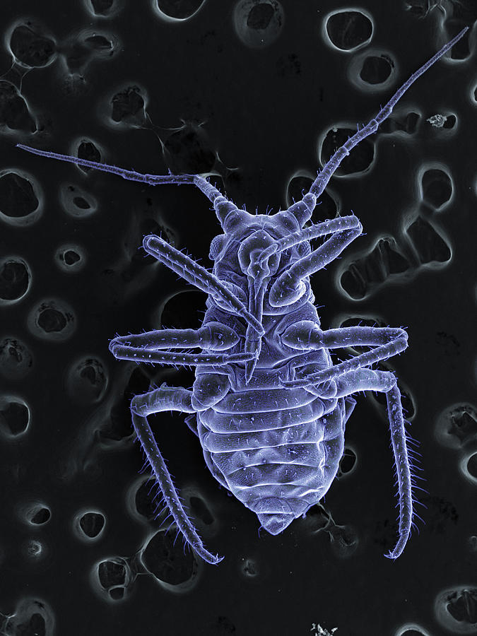 Nature Digital Art - High Vacuum Sem Image Of Plant Lice #3 by M. Suchea And I.v. Tudose
