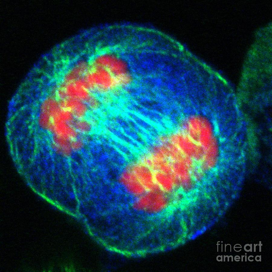 Human Cell In Anaphase #3 Photograph by Dr Matthew Daniels/science Photo Library