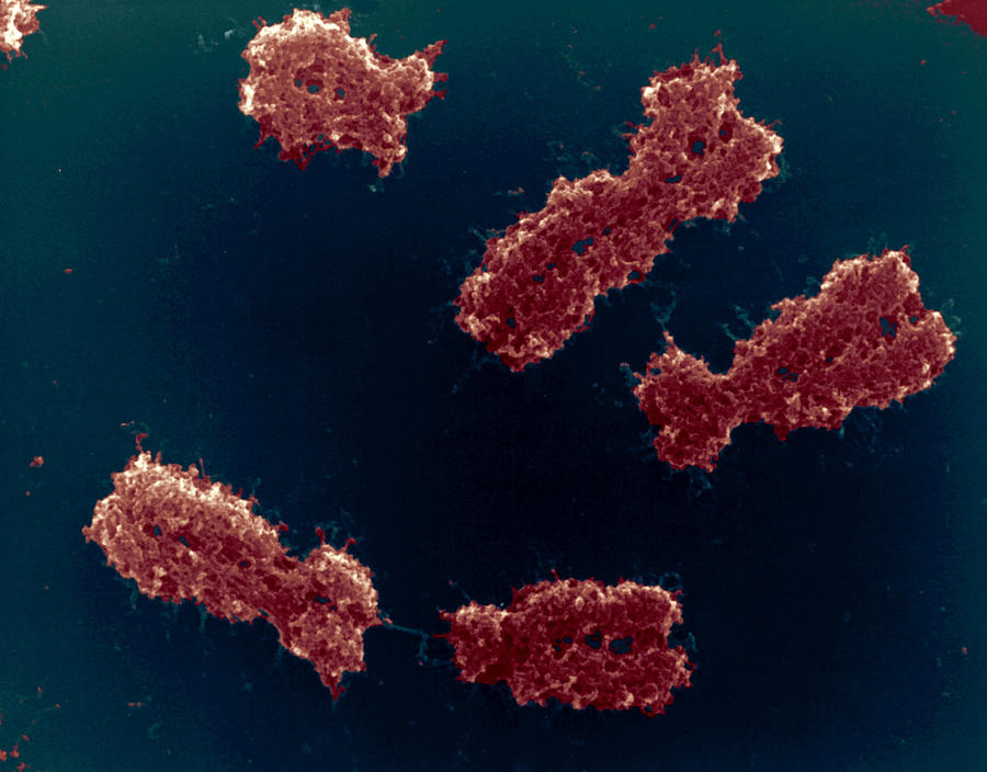 Human Chromosomes #3 Photograph by Meckes/ottawa