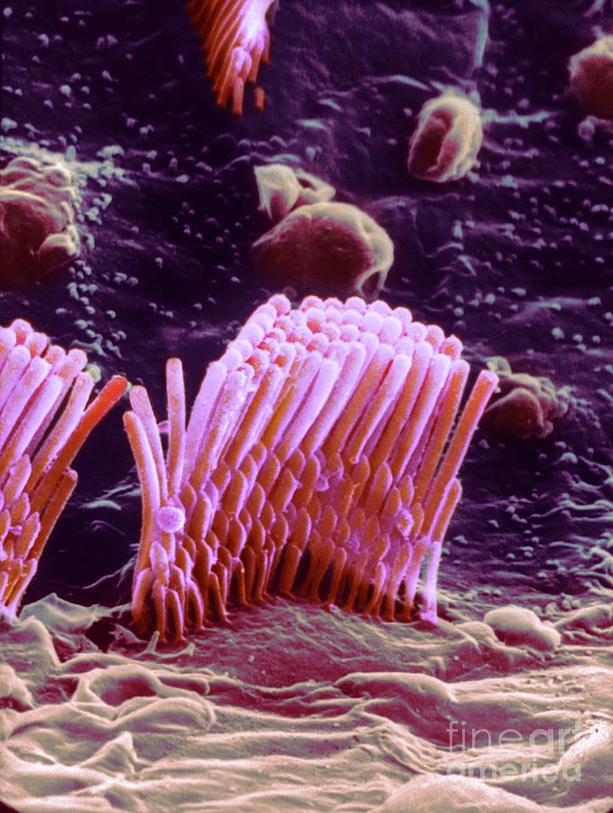 Human Ear Hair Cell #3 Photograph by Professor Tony Wright, Institute Of Laryngology & Otology/science Photo Library