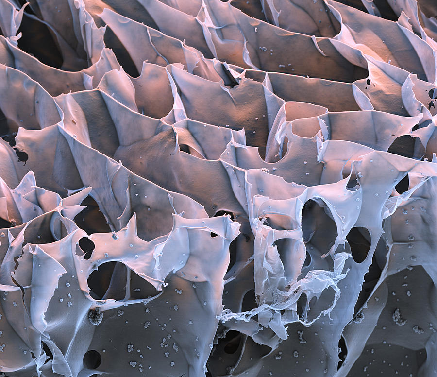 Hydrogel Of Synthetic Spider Silk, Sem #3 Photograph by Meckes/ottawa