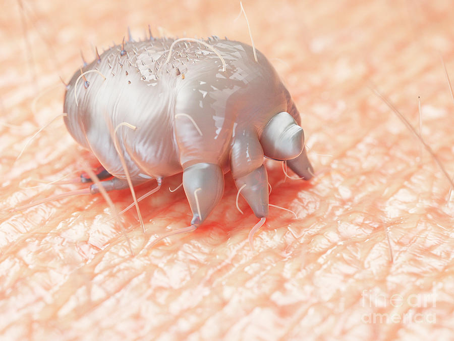 Illustration Of A Scabies Mite On Human Skin Photograph By Sebastian Kaulitzkiscience Photo Library 1343