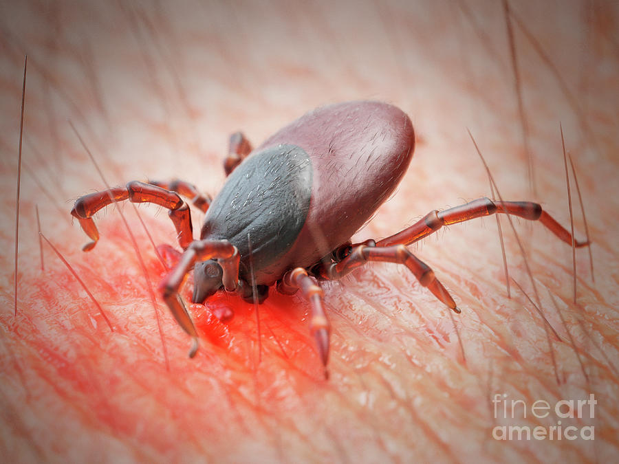 Illustration Of A Tick Biting Human Skin Photograph by Sebastian ...