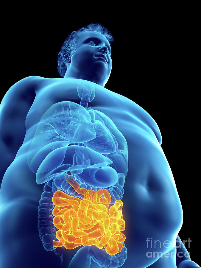 Illustration Of An Obese Mans Intestine #3 Photograph by Sebastian Kaulitzki/science Photo Library