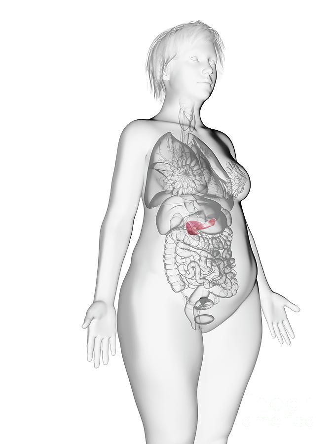 3d Photograph - Illustration Of An Obese Womans Pancreas #3 by Sebastian Kaulitzki/science Photo Library