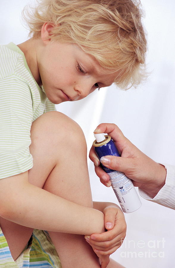 Injured Boy Photograph By Lea Paterson/science Photo Library - Pixels