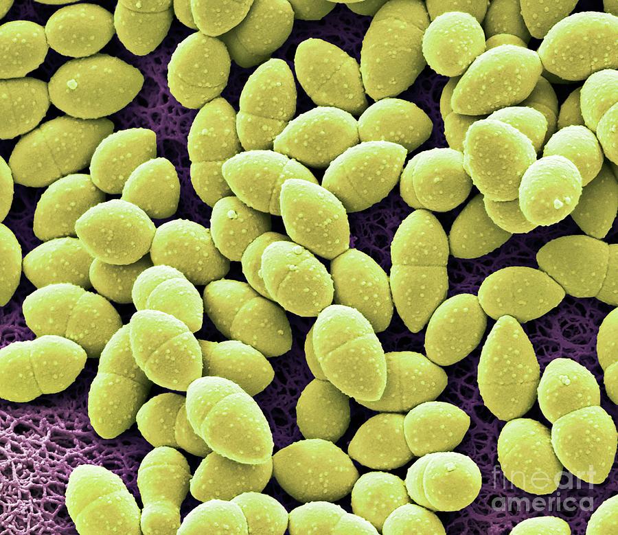 Kefir Bacteria #3 Photograph by Steve Gschmeissner/science Photo Library