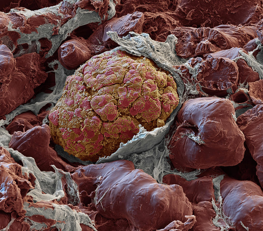 Kidney Glomerulus, Sem #3 Photograph by Oliver Meckes EYE OF SCIENCE