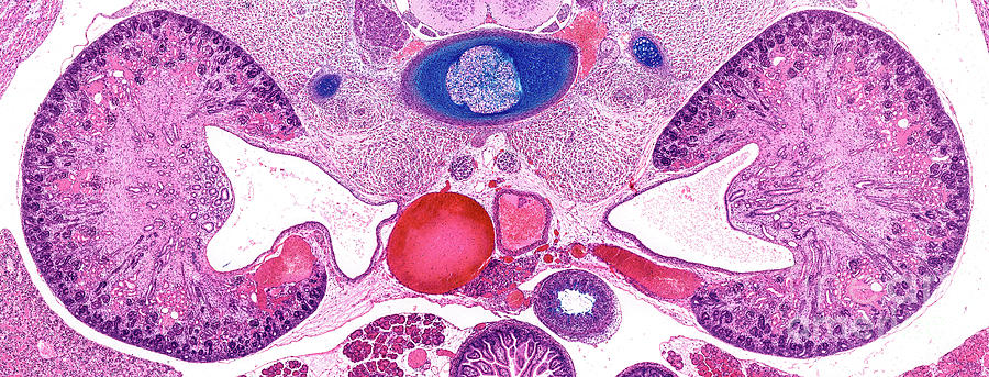 Kidney #3 Photograph by Microscape/science Photo Library