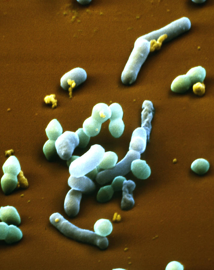 Lactic Acid Bacteria #3 Photograph by Meckes/ottawa
