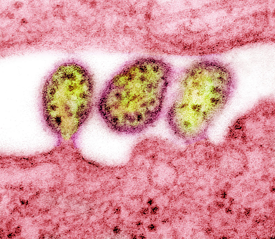 Lassa Virus, Tem #3 Photograph by Science Source