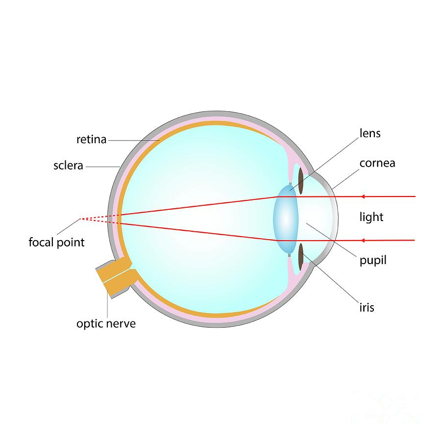 Long Sightedness Photograph by Cordelia Molloy/science Photo Library ...