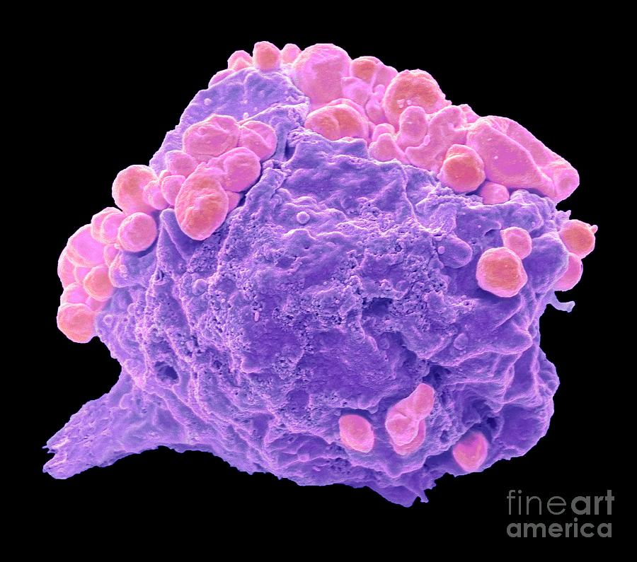 Lymphoma Cancer Cell Photograph By Steve Gschmeissnerscience Photo Library Fine Art America