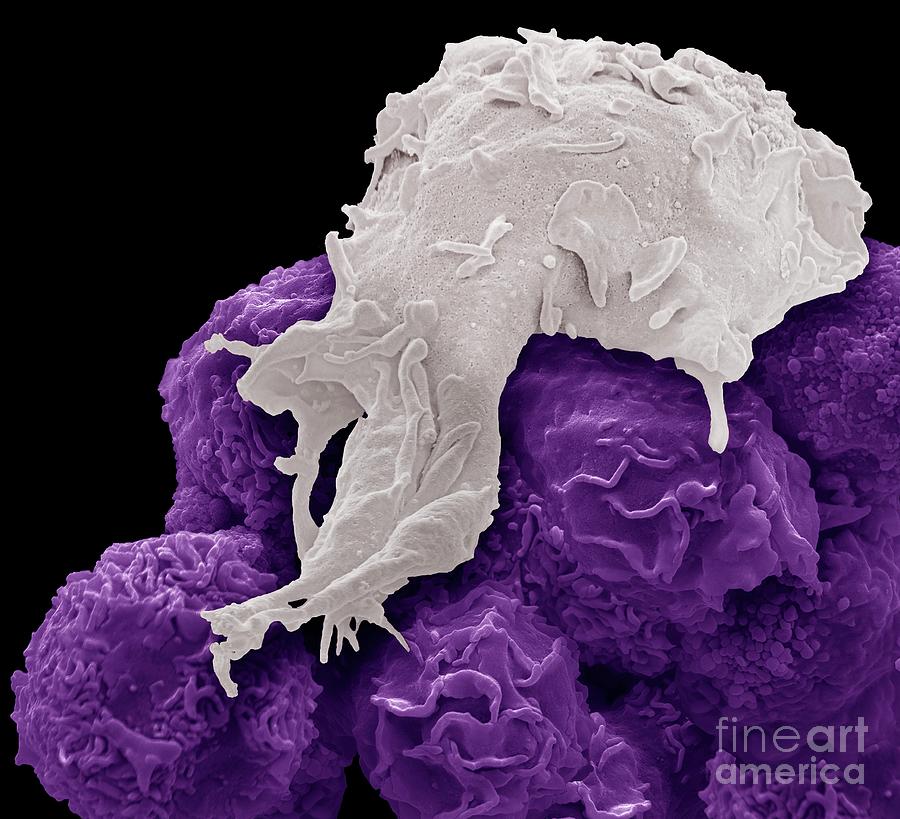 Macrophage And Cancer Cells Photograph By Steve Gschmeissner Science Photo Library Fine Art