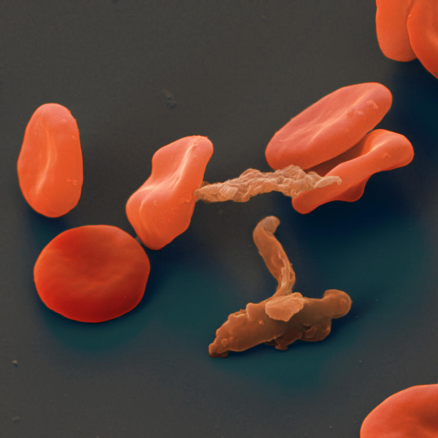 Malarial Parasites #3 Photograph by Meckes/ottawa