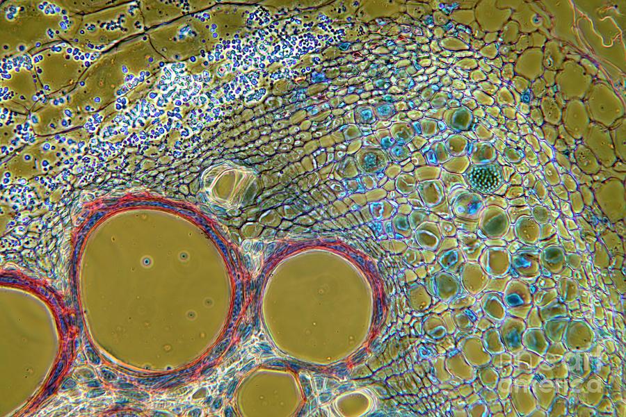 Marrow Stem #3 Photograph by Dr Keith Wheeler/science Photo Library