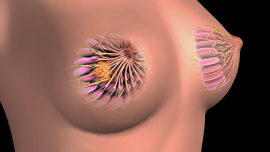 Medical Illustration Showing Breast #3 Photograph by Stocktrek Images