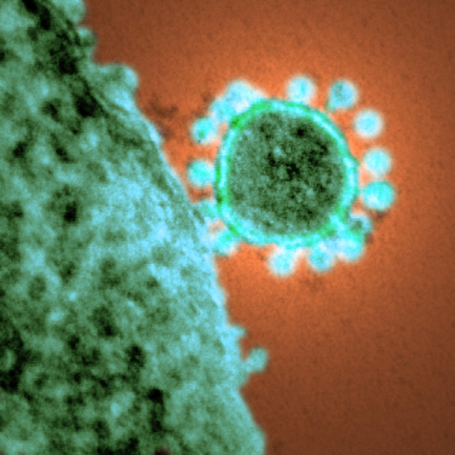 Mers Coronavirus, Tem #3 Photograph by Science Source