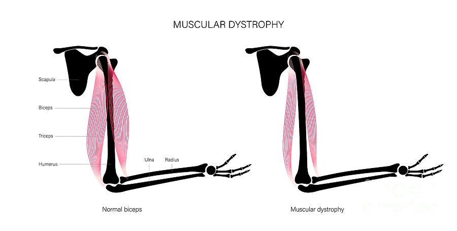 Biceps And Triceps Muscles #2 Photograph by Pikovit / Science