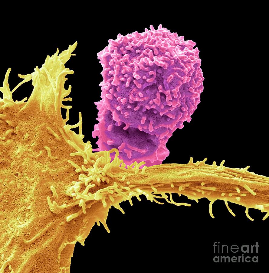 Natural Killer Cell And Cancer Cell Photograph By Steve Gschmeissnerscience Photo Library 7937