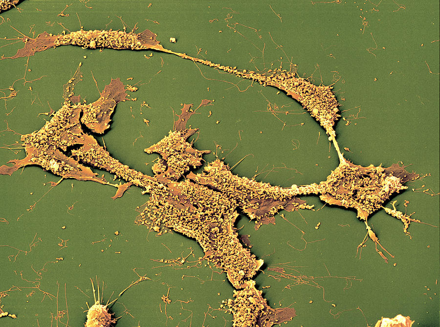 Neuroblastoma Cells #3 Photograph by Meckes/ottawa