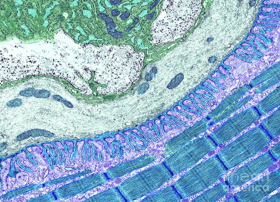 Neuromuscular Junction #3 Photograph by Thomas Deerinck, Ncmir/science Photo Library