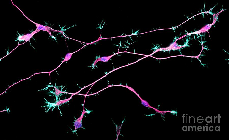 Neurons From Stem Cells #3 Photograph by Dr Torsten Wittmann/science Photo Library
