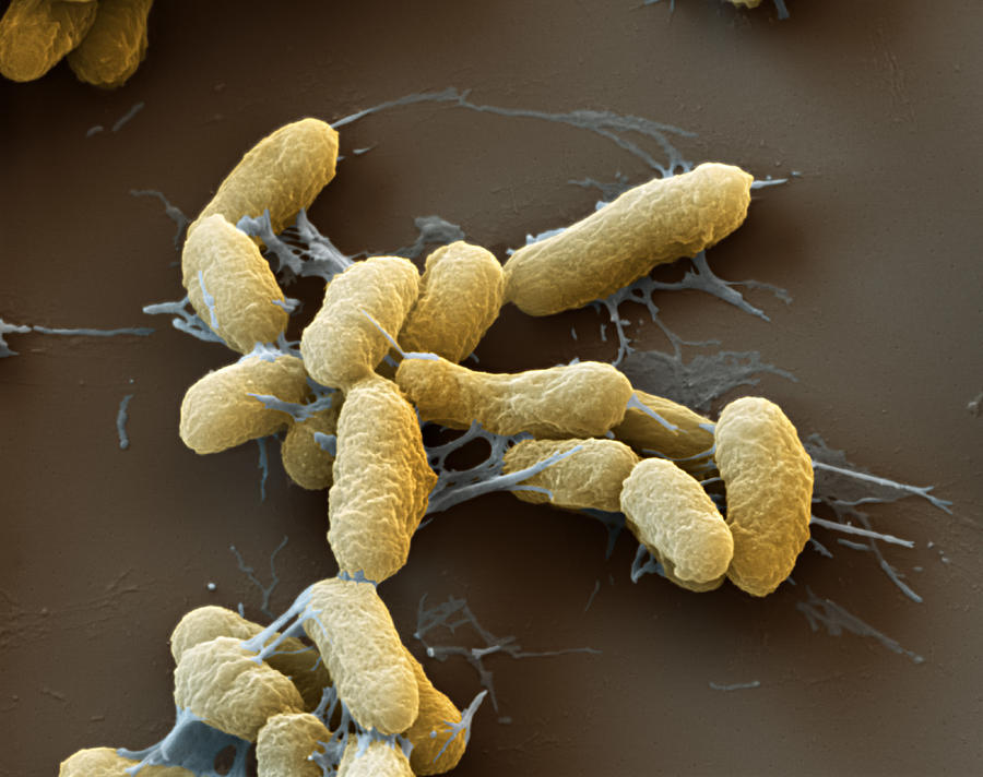 Plague Bacteria Yersinia Pestis, Sem #3 Photograph by Meckes/ottawa