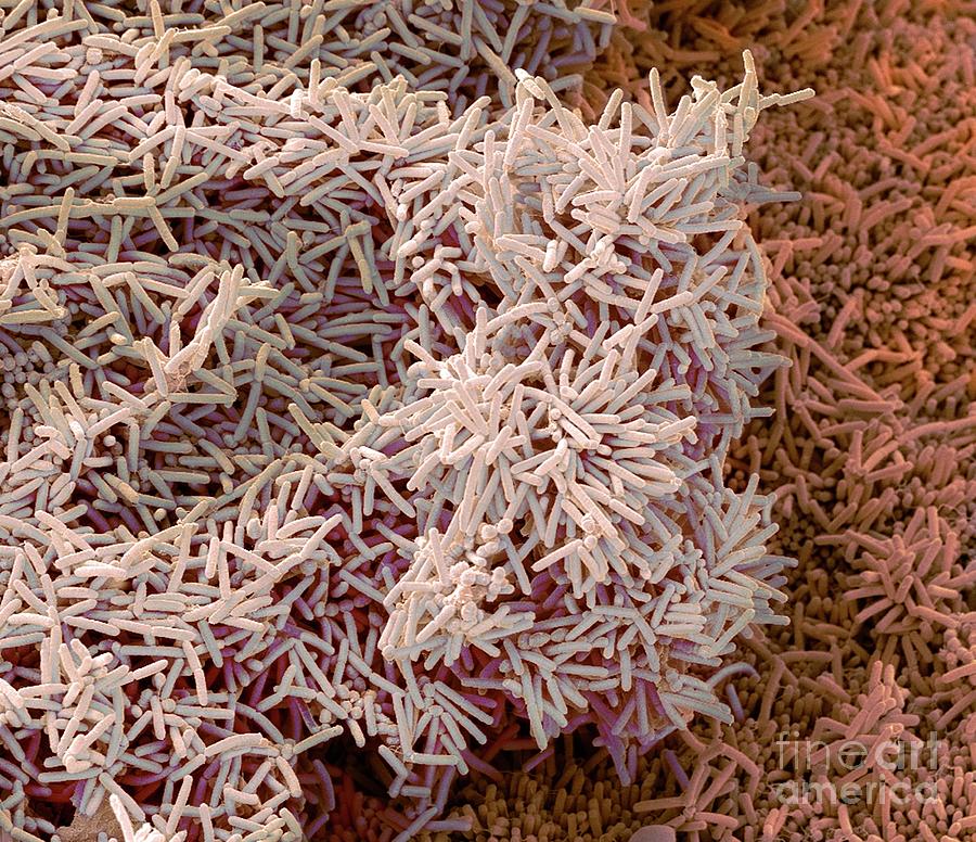 Plaqueforming Bacteria Photograph by Steve Gschmeissner/science Photo