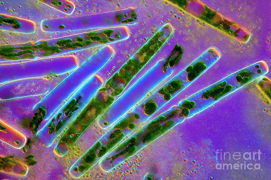 Pleurotaenium Ehrenbergii Algae #3 Photograph by Frank Fox/science Photo Library